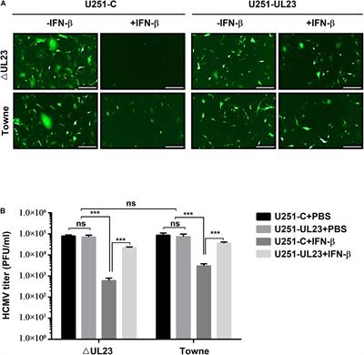 Human Cytomegalovirus UL23 Attenuates Signal Transducer and Activator of Transcription 1 Phosphorylation and Type I Interferon Response